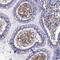 Thymidine Phosphorylase antibody, HPA001072, Atlas Antibodies, Immunohistochemistry paraffin image 