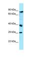 ADP Ribosylation Factor Guanine Nucleotide Exchange Factor 1 antibody, orb326397, Biorbyt, Western Blot image 