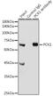 Phosphoenolpyruvate Carboxykinase 1 antibody, GTX54629, GeneTex, Immunoprecipitation image 