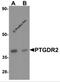 Prostaglandin D2 receptor-like antibody, 7191, ProSci Inc, Western Blot image 