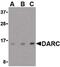 Atypical Chemokine Receptor 1 (Duffy Blood Group) antibody, PA5-20360, Invitrogen Antibodies, Western Blot image 