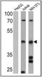Somatostatin receptor type 4 antibody, NB100-74539, Novus Biologicals, Western Blot image 
