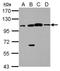 FA Core Complex Associated Protein 100 antibody, NBP2-15635, Novus Biologicals, Western Blot image 
