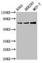 Receptor Interacting Serine/Threonine Kinase 1 antibody, LS-C679278, Lifespan Biosciences, Western Blot image 