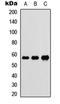 Gamma-Glutamyltransferase 1 antibody, orb234796, Biorbyt, Western Blot image 