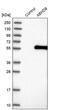 Abhydrolase Domain Containing 8 antibody, PA5-58044, Invitrogen Antibodies, Western Blot image 