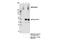 ATP Binding Cassette Subfamily C Member 1 antibody, 14685S, Cell Signaling Technology, Immunoprecipitation image 