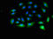 Ribosomal Protein L13a antibody, orb51162, Biorbyt, Immunocytochemistry image 