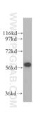 Delta-1-pyrroline-5-carboxylate dehydrogenase, mitochondrial antibody, 11604-1-AP, Proteintech Group, Western Blot image 