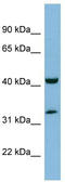 MOK Protein Kinase antibody, TA345116, Origene, Western Blot image 
