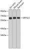 Dihydropyrimidinase Like 5 antibody, 18-844, ProSci, Western Blot image 