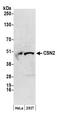 COP9 Signalosome Subunit 2 antibody, NB100-363, Novus Biologicals, Western Blot image 