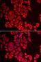 Glutaminyl-Peptide Cyclotransferase antibody, orb373456, Biorbyt, Immunofluorescence image 