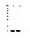 Secretoglobin Family 1A Member 1 antibody, A02201-2, Boster Biological Technology, Western Blot image 