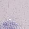 IGF Like Family Member 4 antibody, PA5-61564, Invitrogen Antibodies, Immunohistochemistry paraffin image 