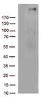 Complement Component 4B (Chido Blood Group), Copy 2 antibody, CF813010, Origene, Western Blot image 