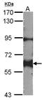 YES Proto-Oncogene 1, Src Family Tyrosine Kinase antibody, LS-B4193, Lifespan Biosciences, Western Blot image 