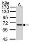 Multiple Inositol-Polyphosphate Phosphatase 1 antibody, TA308980, Origene, Western Blot image 