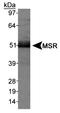 SCARA1 antibody, TA336699, Origene, Western Blot image 