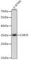 Calcium Binding Protein 39 antibody, 16-446, ProSci, Western Blot image 