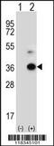 Angiopoietin-related protein 7 antibody, 56-561, ProSci, Western Blot image 