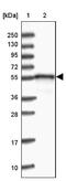 DnaJ Heat Shock Protein Family (Hsp40) Member C3 antibody, NBP2-48704, Novus Biologicals, Western Blot image 