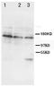 Insulin Receptor antibody, PA1205, Boster Biological Technology, Western Blot image 