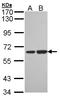 Sorting nexin-18 antibody, LS-C185789, Lifespan Biosciences, Western Blot image 