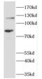 Solute Carrier Family 3 Member 2 antibody, FNab01511, FineTest, Western Blot image 