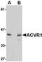 Activin A Receptor Type 1 antibody, orb75057, Biorbyt, Western Blot image 