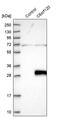 Chromosome 6 Open Reading Frame 120 antibody, PA5-58864, Invitrogen Antibodies, Western Blot image 