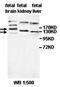 Membrane Associated Guanylate Kinase, WW And PDZ Domain Containing 3 antibody, orb77803, Biorbyt, Western Blot image 