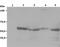 LYN Proto-Oncogene, Src Family Tyrosine Kinase antibody, MA1-19334, Invitrogen Antibodies, Western Blot image 
