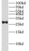Dynactin Subunit 6 antibody, FNab02276, FineTest, Western Blot image 