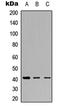 5'-Nucleotidase, Cytosolic IA antibody, LS-C368614, Lifespan Biosciences, Western Blot image 