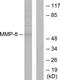 Matrix Metallopeptidase 8 antibody, TA314204, Origene, Western Blot image 