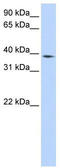 Neutrophil cytosol factor 4 antibody, TA338966, Origene, Western Blot image 