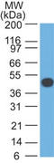Keratin 18 antibody, AM50133PU-S, Origene, Western Blot image 