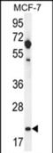 Claudin 25 antibody, PA5-71639, Invitrogen Antibodies, Western Blot image 