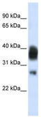 RNase H1 antibody, TA345822, Origene, Western Blot image 