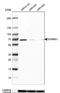 Sorbin And SH3 Domain Containing 1 antibody, NBP2-33383, Novus Biologicals, Western Blot image 