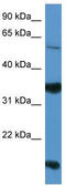 Netrin G2 antibody, TA342923, Origene, Western Blot image 