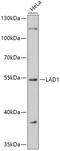 Ladinin 1 antibody, 16-961, ProSci, Western Blot image 