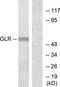 Glucagon receptor antibody, TA313915, Origene, Western Blot image 