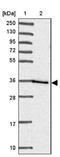 Homeobox C13 antibody, NBP2-47428, Novus Biologicals, Western Blot image 