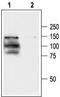 Transient Receptor Potential Cation Channel Subfamily V Member 1 antibody, TA328740, Origene, Western Blot image 