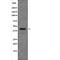 XPA, DNA Damage Recognition And Repair Factor antibody, abx219378, Abbexa, Western Blot image 