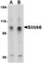 SLIT And NTRK Like Family Member 6 antibody, MBS150887, MyBioSource, Western Blot image 
