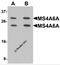 Membrane Spanning 4-Domains A6A antibody, 6593, ProSci Inc, Western Blot image 