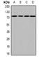 Heparanase 2 (Inactive) antibody, orb341458, Biorbyt, Western Blot image 